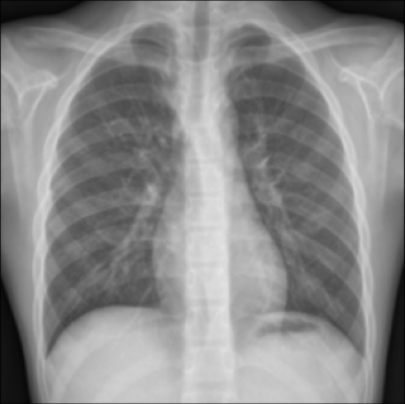 X-ray preview
